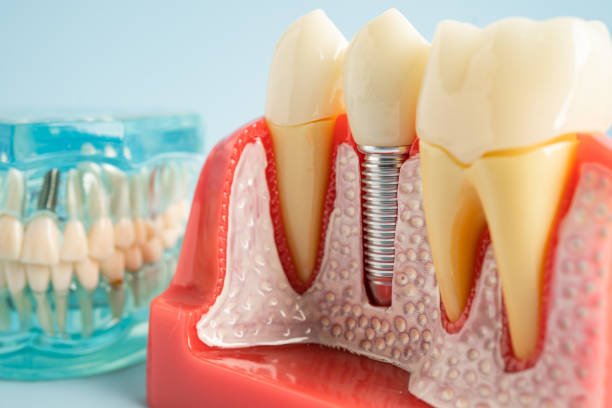 Best General Dentistry  in Newport, KY